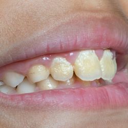 Estetica Dental Y Ortodoncia