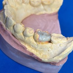 Eval Clínica Dental