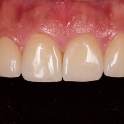 Family Dental Care