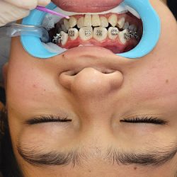 Fareca Dental