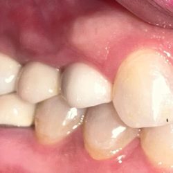 Gio Dental & Med Spa
