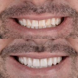 Godent Clinic Especialidades Dentales
