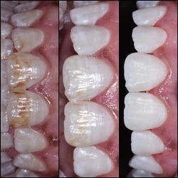 Grandental Irapuato