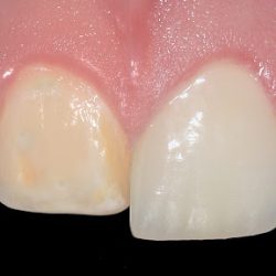Grupo Dental Antea