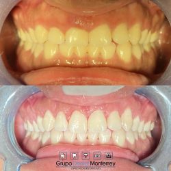 Grupo Dental Monterrey