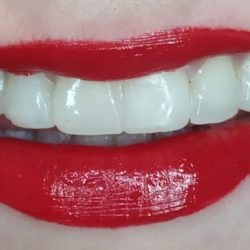 Hade Dental