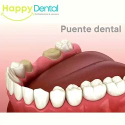 Happy Dental Nogales