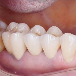 High Esthetics Dental: Dr. Oscar Elizondo & Dr. Osiel Casarez