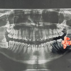 Hospident Clínica Dental