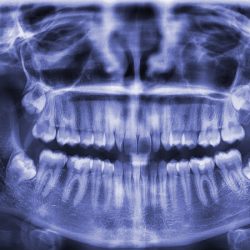Imadi Radiología Dental