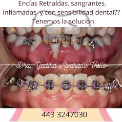 Inndental Morelia