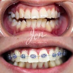 Jcn Clínica Dental / Dra. Johana Castro