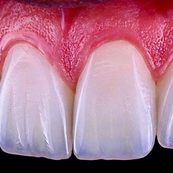 Ka Dental