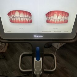 Kerosmile