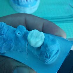 Laboratorio Dental 