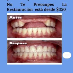Laboratorio Dental New-dent's