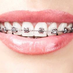 Leticia Polo Cirujano Dentista