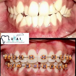 Lukas Dent Consultorio Dental