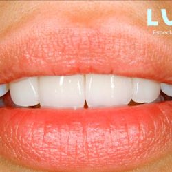 Lumy Dental Querétaro Centro Histórico