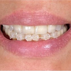 Marfil Clínica Dental