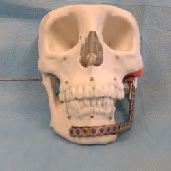 Maxilocenter - Clínica De Cirugía Oral Y Maxilofacial