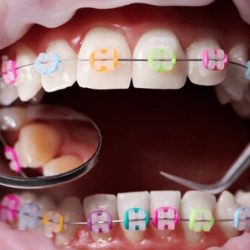 Mb Dental Odontologia Especializada