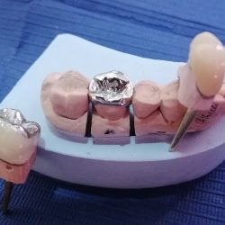Medicaldent´s ( Rehabilitando La Función Y Estética Dental)