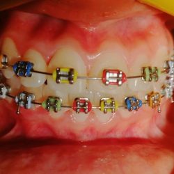 Medicdents