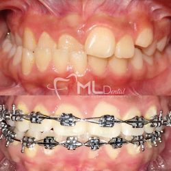 Ml Dental Apatzingán