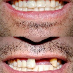 Muab Dental