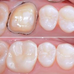 Neodent Sj