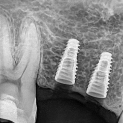 Nogales Dental Center