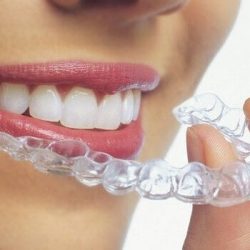 Nogales Periodental Dr. Ariel Ochoa Cuen