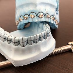 Novo-r Odontología