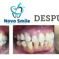 Novo Smile