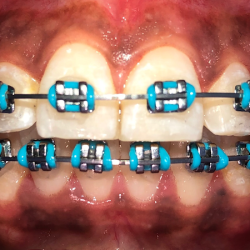 Núcleo Dental Rubén Illán