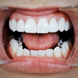 Obg Dentista En Guadalajara