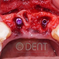 Odent Clínica Dental