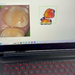 Odonto Esthetic