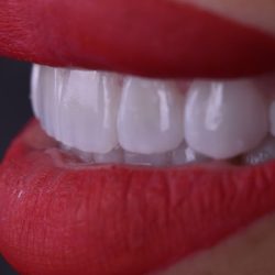 Odontología Digital Estética