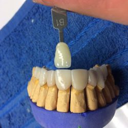 Odontologia. Dr Oscar Alejandro Retana Alvarez Dentistry