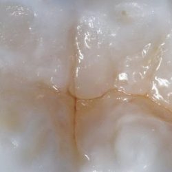 Odontología Estética E Implantes Dentales