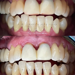 Odontología General Y Especialidades - Morelia