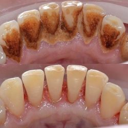 Odontologia Integral