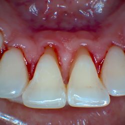Odontología Integral Y Estética Dra. Emma Becerra