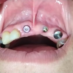 Odontología Y Ortodoncia - Ojo De Agua