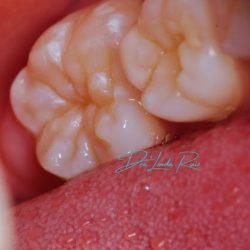 Odontopediatra Dra Linda Ruiz