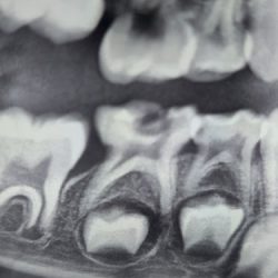 Odontopediatra Xldent Teens