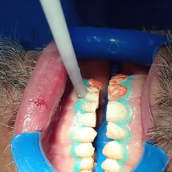 Oprev Clínica Dental