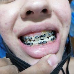 Oral Dental